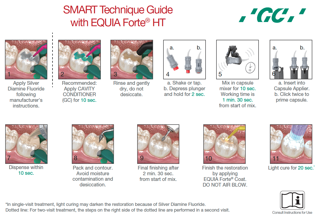 Play it SMART with EQUIA Forte® HT!